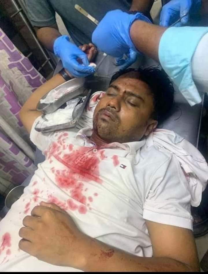 শাহরাস্তিতে ওয়ার্ড আ’লীগ নেতার  হামলায় ছাত্রদল নেতা আহত