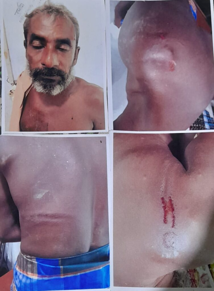 জামিনে এসে বাদীকে হত্যার হুমকি। শাহরাস্তি জমি সংক্রান্ত বিরোধের যের সংঘর্ষ, আহত তিন, থানায় মামলা।