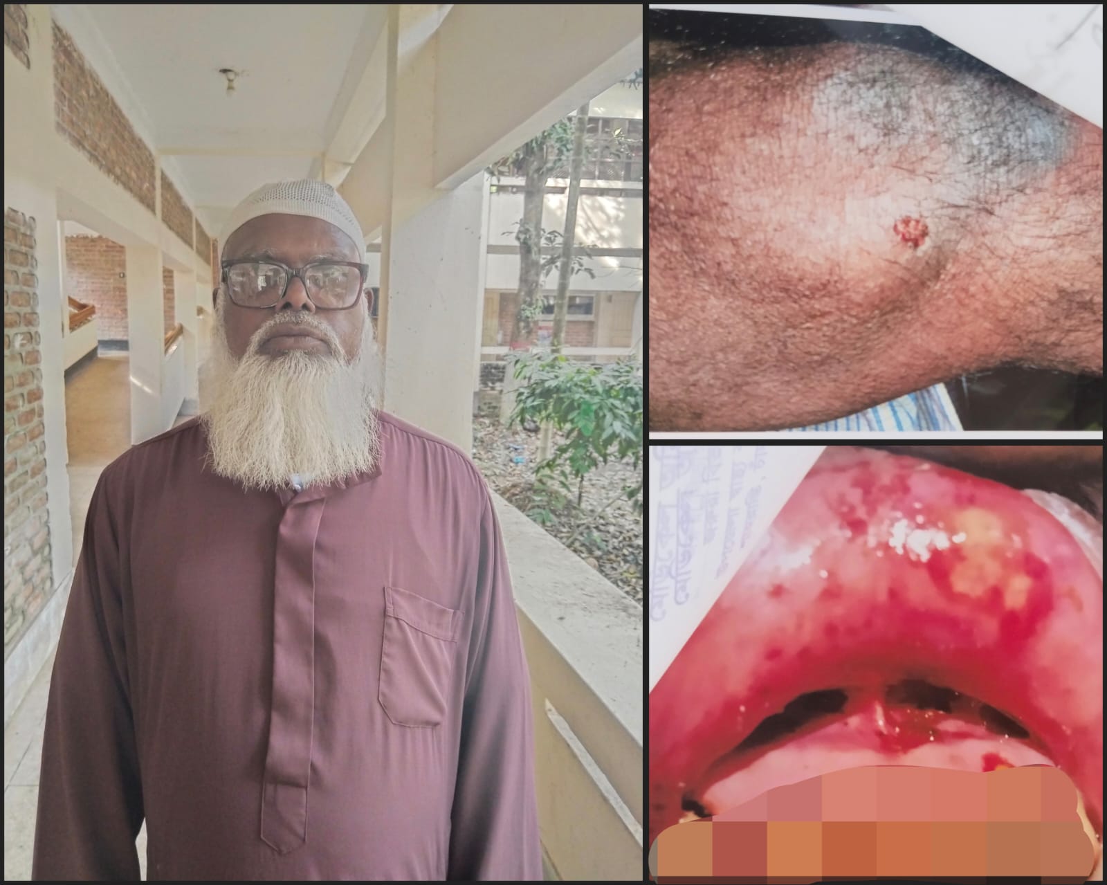 শাহরাস্তিতে জমি নিয়ে বিরোধে, দুই ভাইয়ের মারামারি, ছোট ভাই আহত, থানায় অভিযোগ