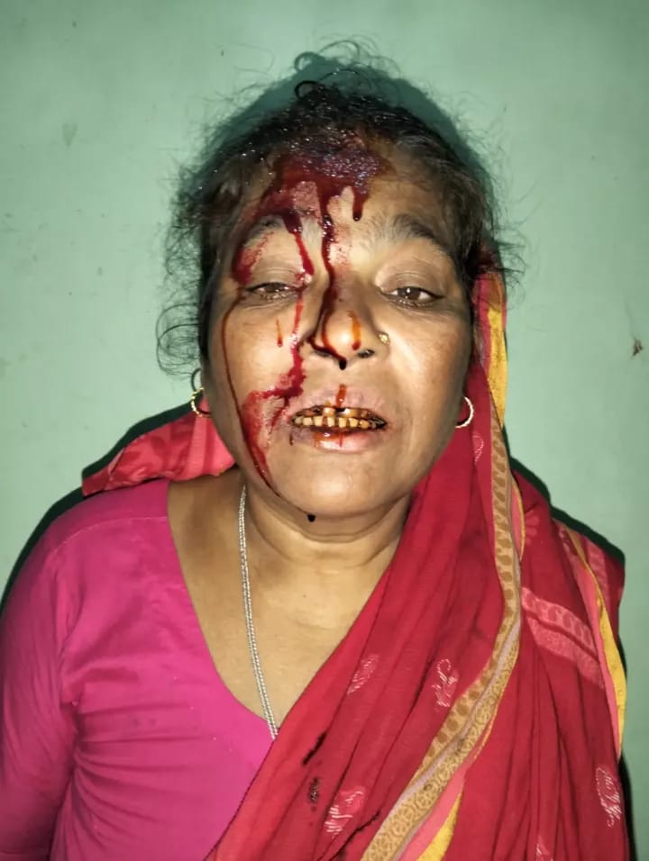 কচুয়ার কেশর কোটে সাক্ষীর মাথা ফাটিয়ে দিল বিবাদী মাসুদ গং,কোর্টে  মামলা।