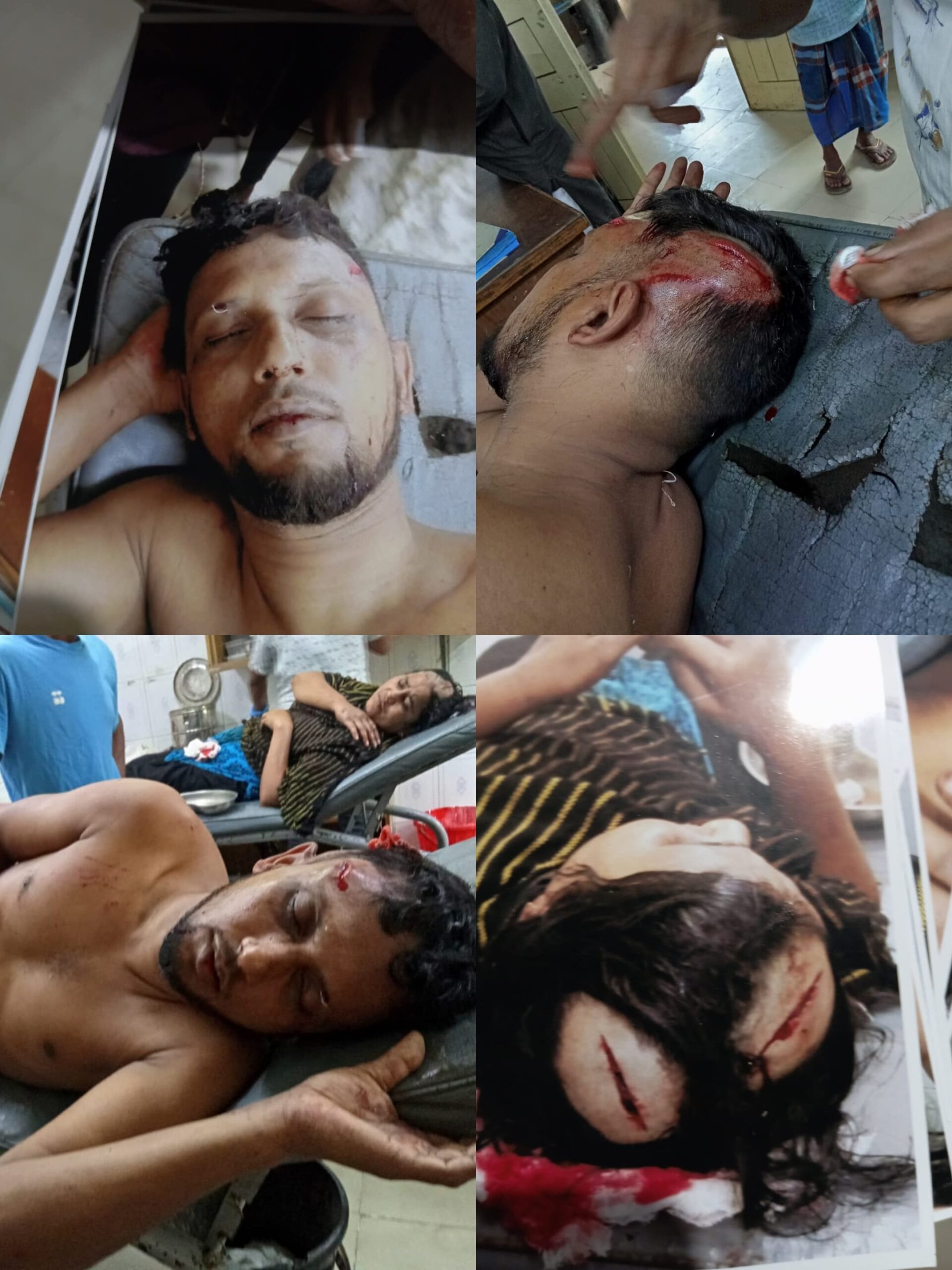 কচুয়ায় ছোট দুই ভাইয়ের হাতে বড় ভাই ও তার পরিবারের সদস্যদের উপর পৈশাচিক হামলা