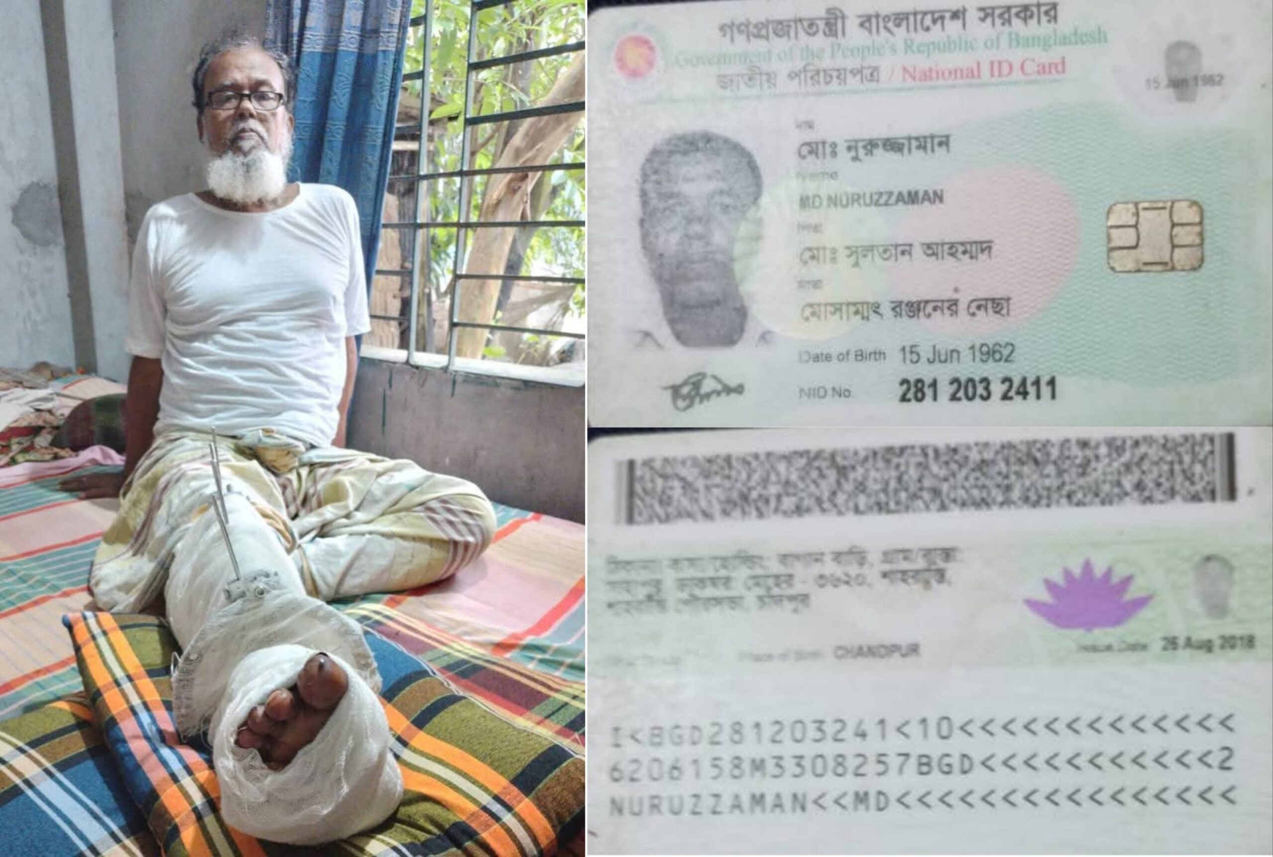 স্বাভাবিক জীবনে ফিরে যেতে চান অসুস্থ নুরুজ্জামান, চিকিৎসার জন্য তার আর্থিক সহায়তা প্রয়োজন!!