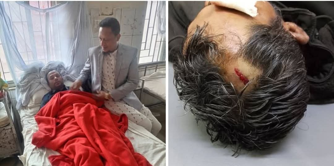শাহরাস্তিতে তুচ্ছ ঘটনা কে কেন্দ্র করে যুবকের উপর  হামলা,    আহত ২, থানায় মামলা।