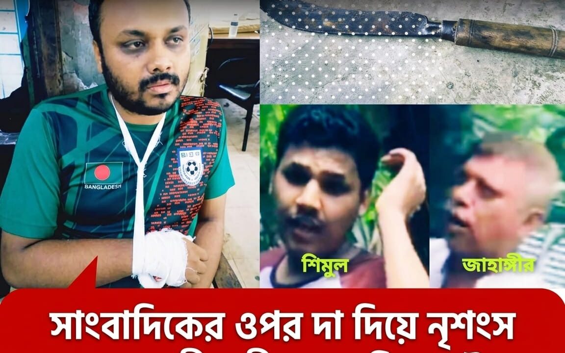 শাহরাস্তিতে সাংবাদিকের ওপর চাচা-চাচাতো ভাইয়ের হামলা, কুপিয়ে জখম, স্ত্রীর শ্লীলতাহানির অভিযোগ